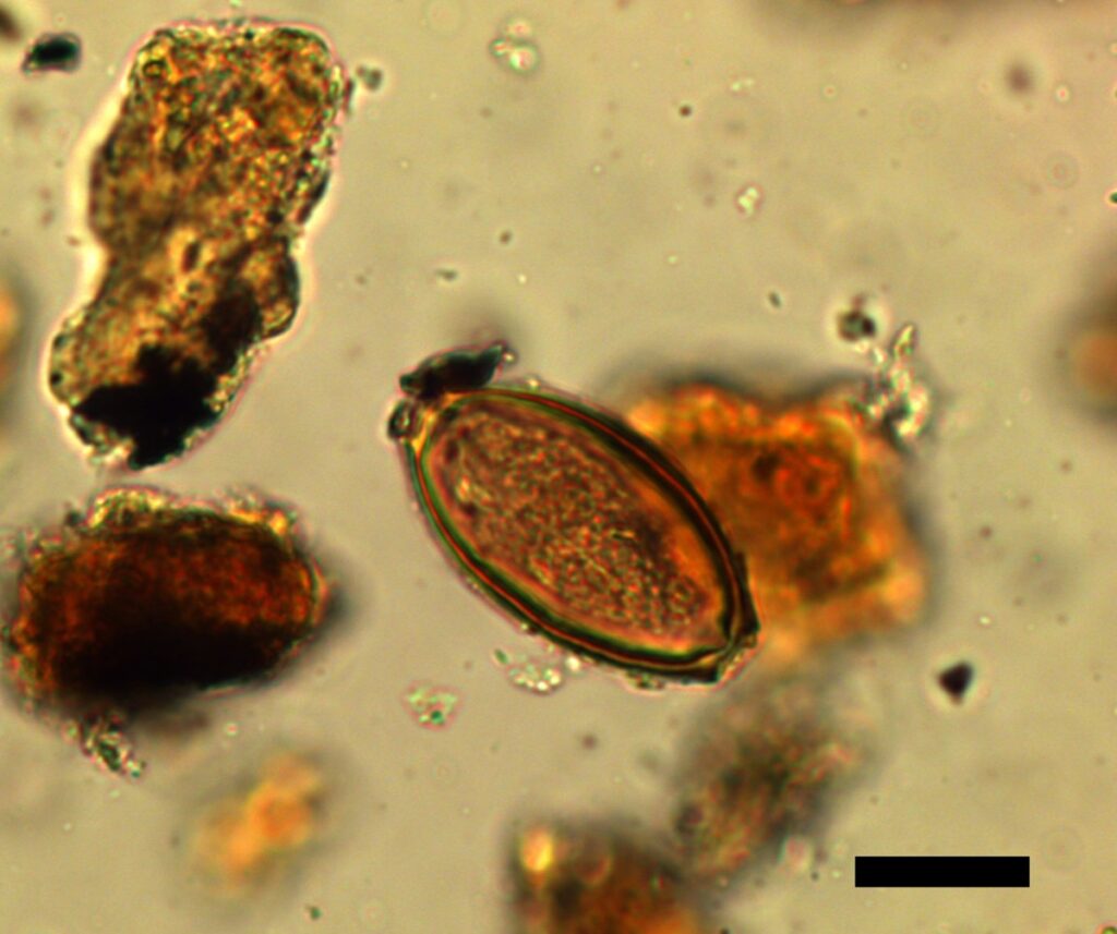 Whipworm egg from the analysis of sediment from the sewer drain